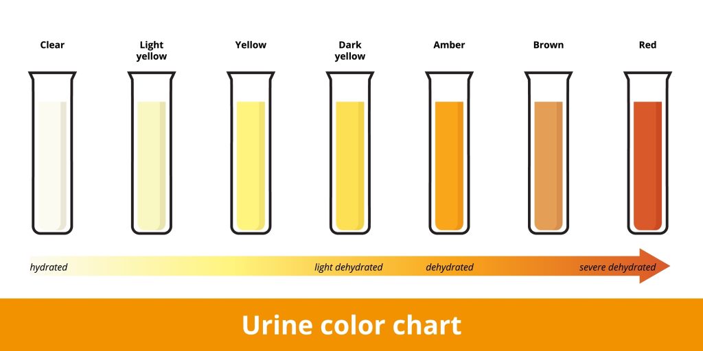 Urine color chart showing hydration levels, with colors ranging from clear (hydrated) to red (severely dehydrated)