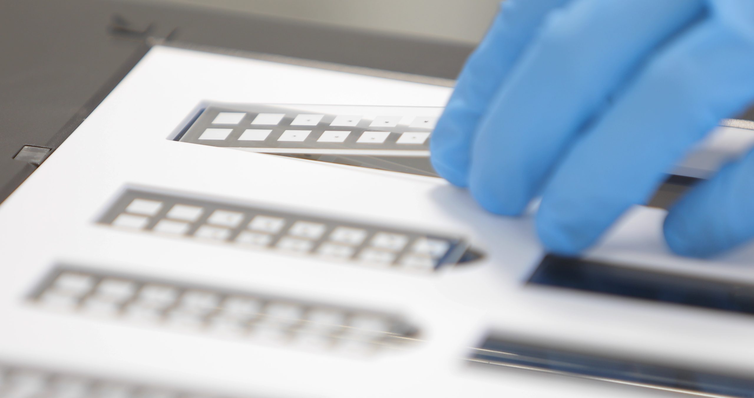 ***IgG food sensitivity testing*** and terminology